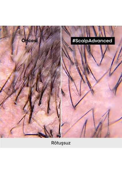 Serie Expert Scalp Advanced Kepek Karşıtı Profesyonel Şampuan 500 ml