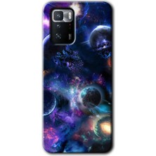 MRC İletişim Poco X3 Gt Kılıf Hd Desen Baskılı Arka Kapak - Gezegen Karışımı