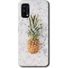 MRC İletişim Realme 7 Pro Kılıf Hd Desen Baskılı Arka Kapak - Ananas