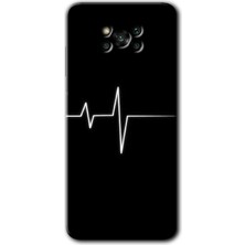 MRC İletişim Poco X3 Pro Kılıf Hd Desen Baskılı Arka Kapak - Heart Rytm
