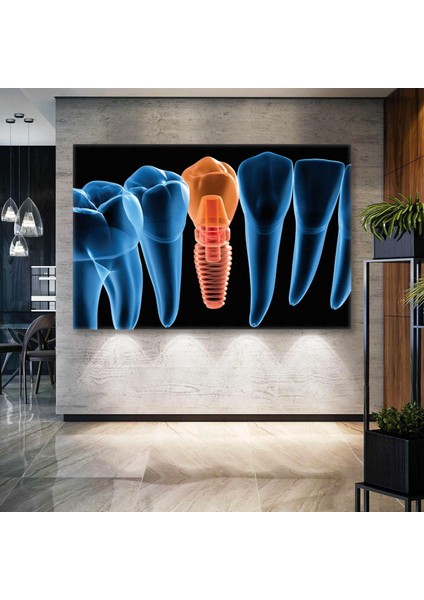 Ağız ve Diş Sağlığı Implant Dişçi Ofis Kanvas Tablo
