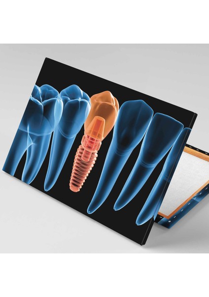 Ağız ve Diş Sağlığı Implant Dişçi Ofis Kanvas Tablo