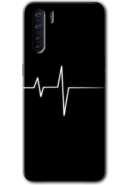 Oppo A91 Kılıf Hd Desen Baskılı Arka Kapak - Heart Rytm