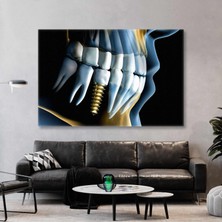 SML Tablo Diş Hekimi Ofisi Gold Implant Ağız ve Diş Sağlığı Kanvas Tablo