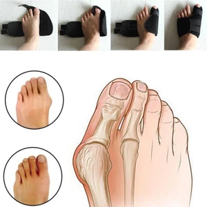 Gece Ayak Başparmak Halluks Valgüs Ateli Medikal Ateli Bunion Koruyucu Ayak Başparmak Kemik Çıktısı Tedavisi