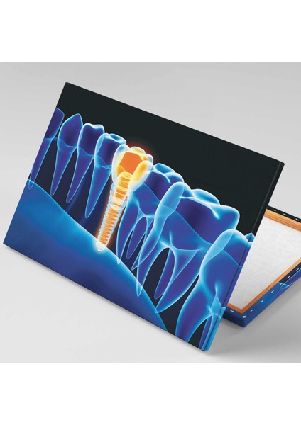 Dişçi Diş Hekimi Ofisi Ağız ve Diş Sağlığı Dentist Kanvas Tablo fiyatları