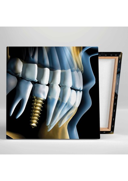 Diş Hekimi Ofisi Gold Implant Ağız ve Diş Sağlığı Kanvas Tablo