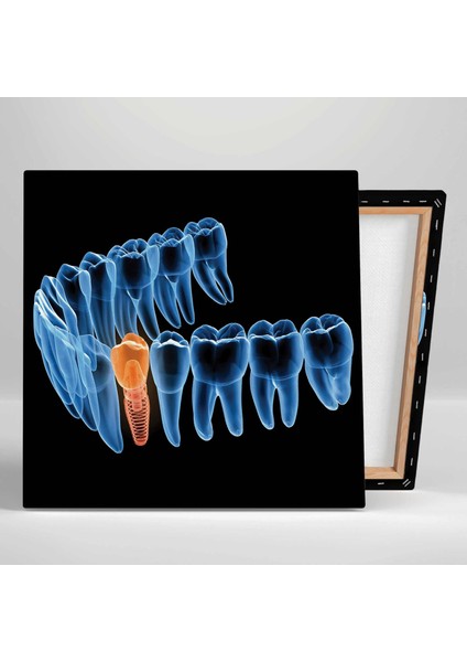 Dişçi Diş Hekimi Ofisi Gülüş Tasarımı Dentist Kanvas Tablo