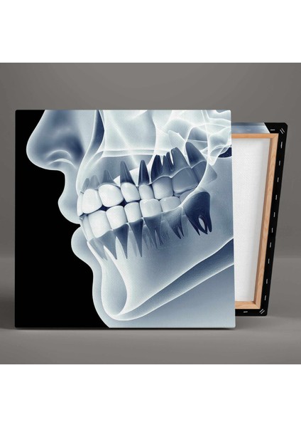 Diş Sağlığı Dişçi Diş Hekimi Çene Röntgeni Dentist Kanvas Tablo