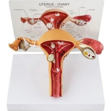Naturachi Uterus Pelvik Taban Maketi Model 41