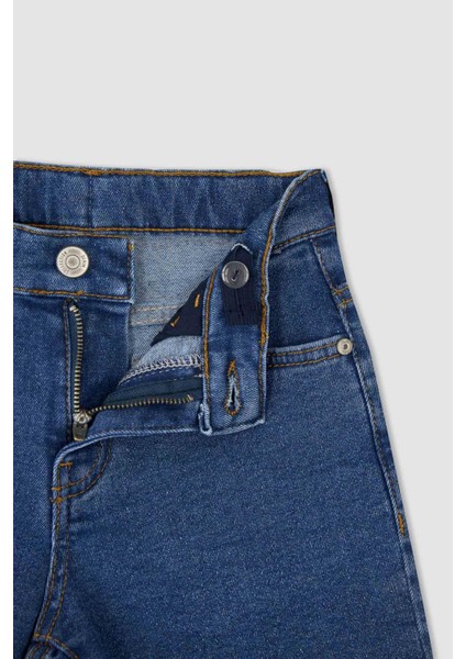 Erkek Çocuk Jean Şort Y9424A622HS