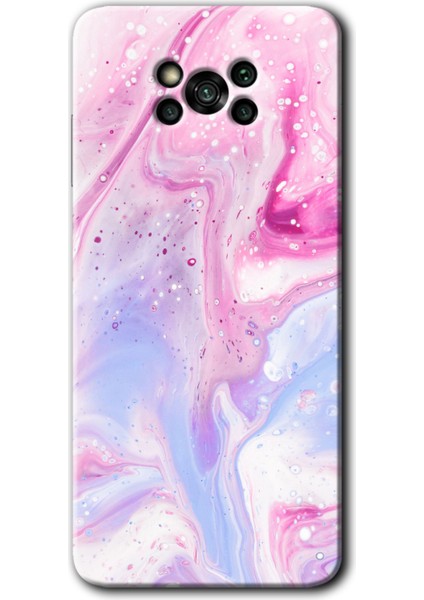 Poco X3 Pro Kılıf Hd Desen Baskılı Arka Kapak - Kabarmış Leke