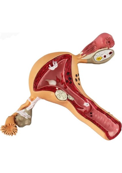Uterus Pelvik Taban Maketi Model 41
