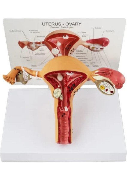 Uterus Pelvik Taban Maketi Model 41 fiyatları