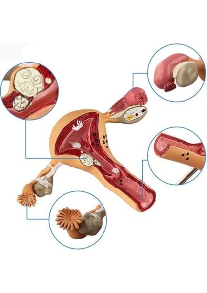 Uterus Pelvik Taban Maketi Model 41 modelleri