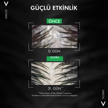 Vichy Dercos Kepek Karşıtı Şampuan Hassas ve Kaşıntılı Saç Derisi 200 ml