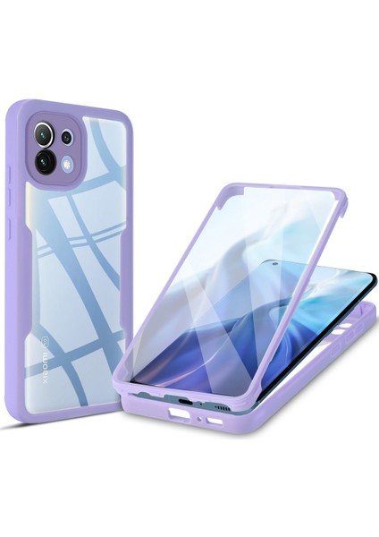 Xiaomi Mi 11 Için Yumuşak Tpu Ekran Koruyucu Telefon Kılıfı - Mor (Yurt Dışından)