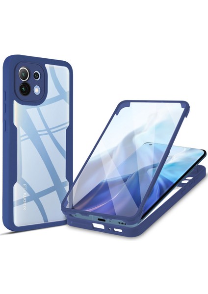 Xiaomi Mi 11 Için Yumuşak Tpu Ekran Koruyucu Telefon Kılıfı - Mavi (Yurt Dışından)