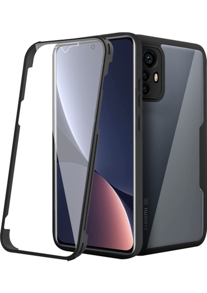 Xiaomi 12 Pro Için Yumuşak Tpu Ekran Koruyucu Telefon Kılıfı - Siyah (Yurt Dışından)