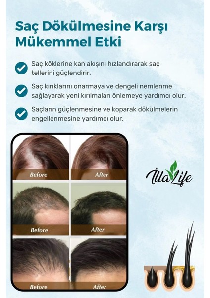 illa Life 9 Aktifli Keratin Biotin Hızlı Etkili Bakım Şampuanı 250 ML modelleri