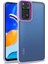 Xiaomi Redmi Note 11 Global Kılıf Case, Kamera Lens Korumalı Elektroplatin Kaplama Sert Pc Koruyucu Colourful Platinum Serisi 1