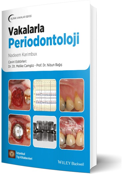 Klinik Vakalar Serisi Vakalarla Periodontoloji