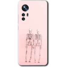 MRC İletişim Xiaomi Mi 12 Kılıf Hd Desen Baskılı Arka Kapak - Yaşayan Çift