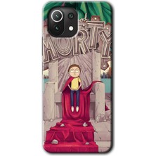 MRC İletişim Xiaomi Mi 11 Lite Kılıf Hd Desen Baskılı Arka Kapak - Morty