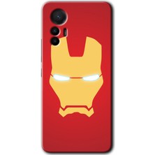 MRC İletişim Xiaomi Mi 12 Lite Kılıf Hd Desen Baskılı Arka Kapak - Ironman
