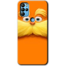 MRC İletişim Omix X500 Kılıf Hd Desen Baskılı Arka Kapak - Garfield