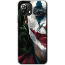 MRC İletişim Xiaomi Mi 11 Lite Kılıf Hd Desen Baskılı Arka Kapak - Joker