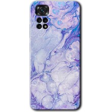 MRC İletişim Xiaomi Redmi Note 11 Pro 5g Kılıf Hd Desen Baskılı Arka Kapak - Spots Lilac