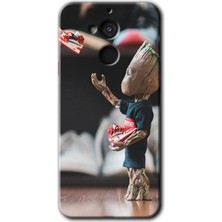 MRC İletişim General Mobile Gm 8 Kılıf Hd Desen Baskılı Arka Kapak + Temperli Cam - I Am Groot