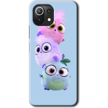 MRC İletişim Xiaomi Mi 11 Kılıf Hd Desen Baskılı Arka Kapak - Puffy