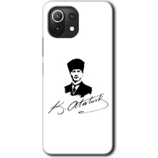 MRC İletişim Xiaomi Mi 11 Kılıf Hd Desen Baskılı Arka Kapak - Kemal Atatürk Imza