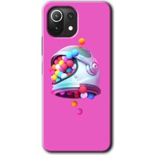 MRC İletişim Xiaomi Mi 11 Kılıf Hd Desen Baskılı Arka Kapak - Uzay Başlığı