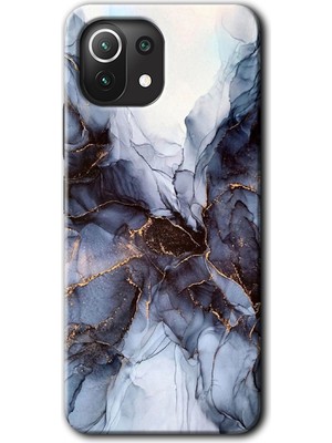 MRC İletişim Xiaomi Mi 11 Kılıf Hd Desen Baskılı Arka Kapak - Otantik Mermer
