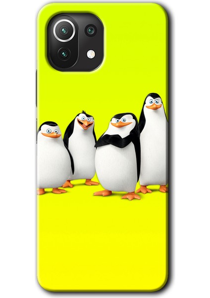 Xiaomi Mi 11 Lite Kılıf Hd Desen Baskılı Arka Kapak - Penguenler
