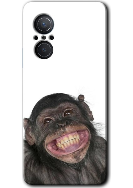 Huawei Nova 9 Se Kılıf Hd Desen Baskılı Arka Kapak - Şıpsevdi Aşk