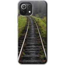 MRC İletişim Xiaomi Mi 11 Lite Kılıf Hd Desen Baskılı Arka Kapak - Tren Yolu