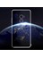 Xiaomi Mi Mix Uyumlu Şeffaf Dayanıklı Silikon Kılıf Uzun Süre Solmaz Sararmaz 1