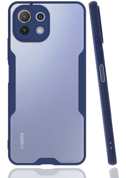 Xiaomi Mi 11 Lite Kılıf Kamera Korumalı Ultra Ince Buzlu Mat Renkli Silikon Kapak(Parfe)