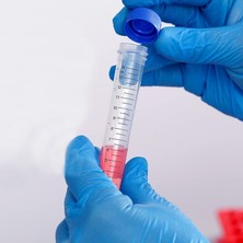 Falkon Tüpü 15 ml / Santrifüj Tüpü - Dibi Konik - 10 Adet