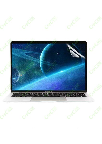 Apple Macbook 13.6' Air 2022 M2 A2681 Kılıf Diamond Pırıltı Şeffaf Kapak+Ekran Koruma+Klavye Koruma