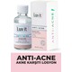 Luv it! Akne Karşıtı Losyon 30 ML