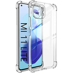 Case World Xiaomi Mi 11 Lite ile Uyumlu Kapak Kamera Korumalı Şeffaf Airbag Antishock Köşe Korumalı Silikon Şeffaf Kılıf