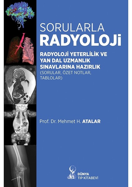 Sorularla Radyoloji: Radyoloji Yeterlilik ve Yan Dal Uzmanlık Sınavlarına Hazırlık Sorular - Özel Notlar -Tablolar