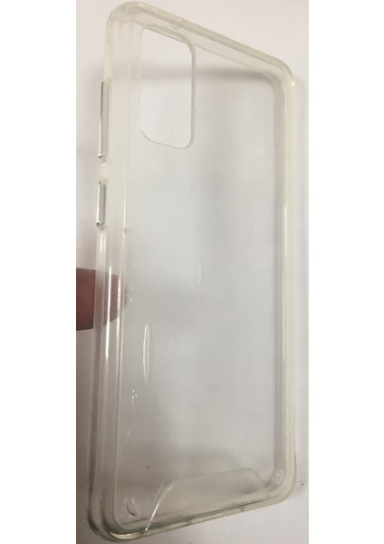 Samsung S20 Darbe Dayanıklı Kalın Metal Düğmeli Lüx Kılıf