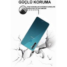 Kılıfmania Infinix S5 Lite ile Uyumlu Kapak Kamera Korumalı Tıpalı Şeffaf Silikon Kılıf