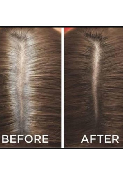 Root Touch-Up Neva Root Kapatıcı Sprey 75ML Kumral - Blonde
